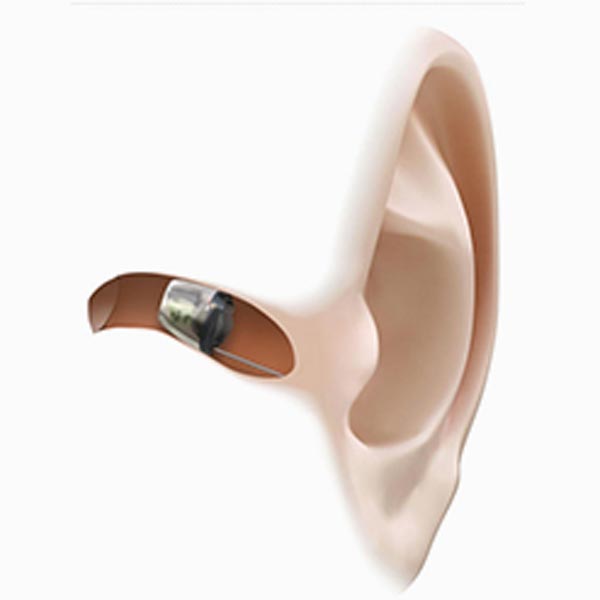 hearing aids sherman oaks ca